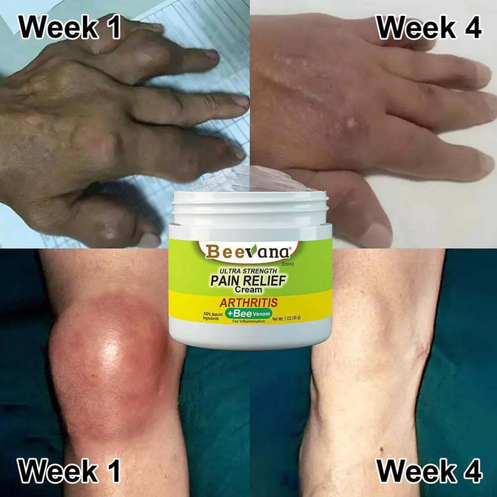 (Pack of 3) BeeTherapy™ #1 Bee Venom Pain Relief Cream | Buy 1 Get 1 Free 🔥
