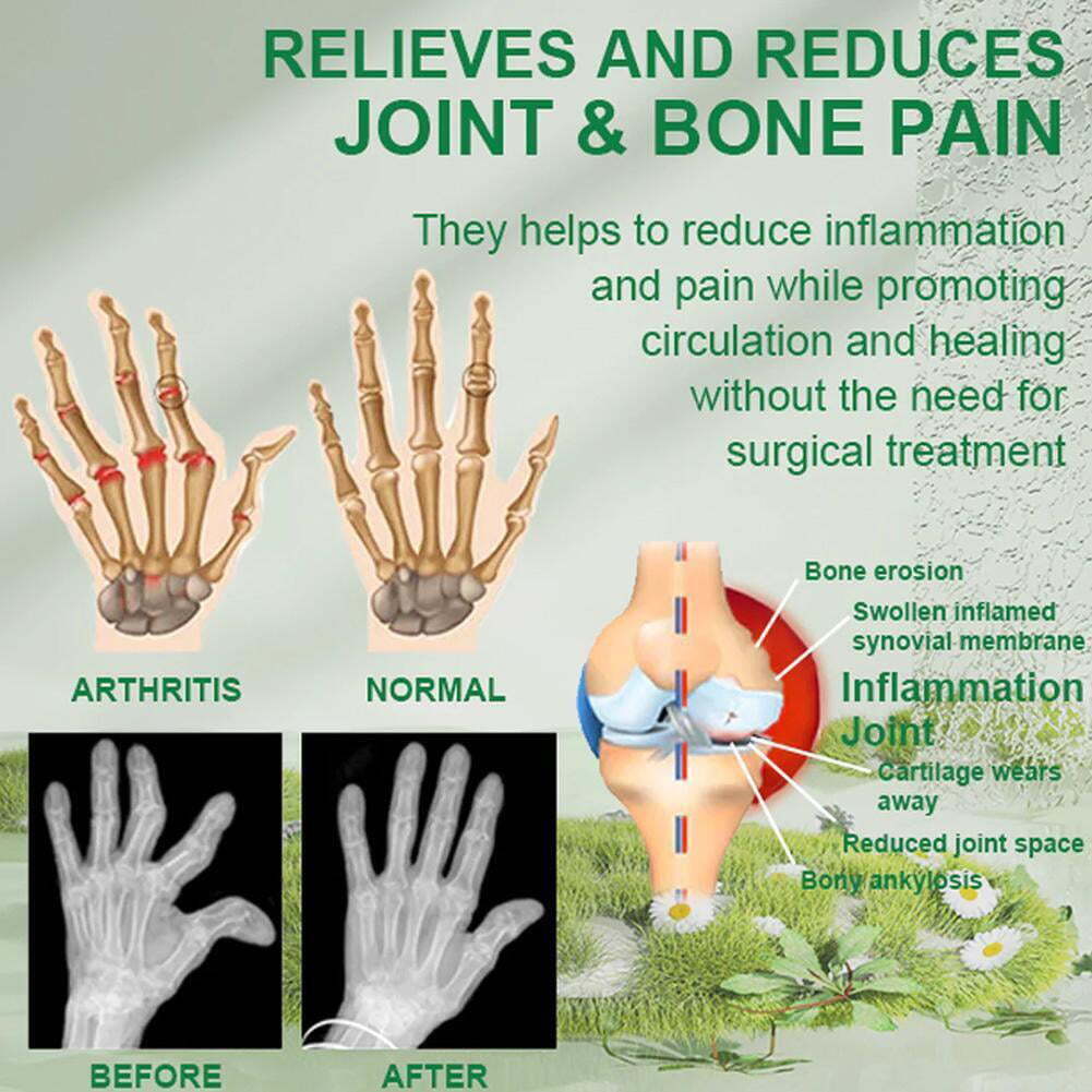 (Pack of 3) BeeTherapy™ #1 Bee Venom Pain Relief Cream | Buy 1 Get 1 Free 🔥